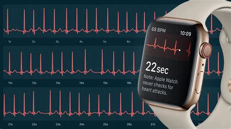 how accurate is apple watch ecg